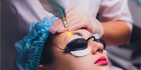 عوارض پاک کردن تاتو ابرو با لیزر عوارض پاک کردن تاتو ابرو با لیزر