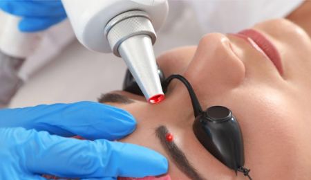 عوارض تاتو ابرو با دستگاه لیزر عوارض تاتو ابرو با دستگاه لیزر